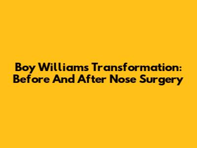Boy William's Transformation: Before And After Nose Surgery