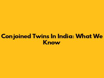 Conjoined Twins In India: What We Know